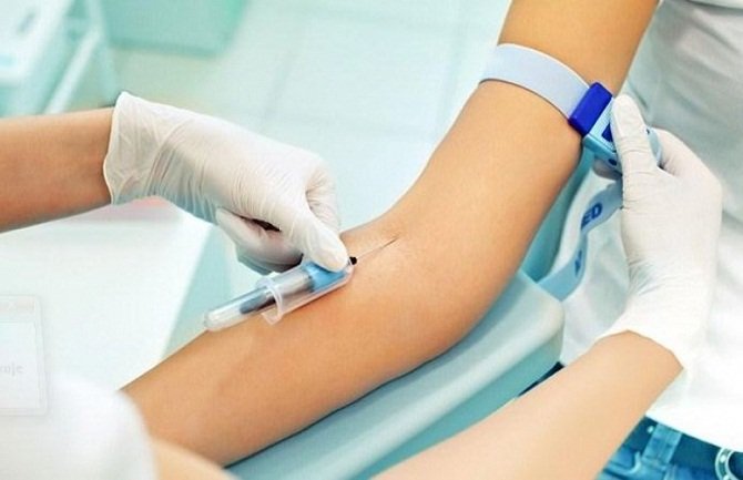 Građani Bijelog Polja od 3.jula laboratorijske nalaze davaće u Domu zdravlja