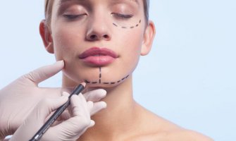 Estetska korekcija popularna i u CG: Dame najviše uvećavaju grudi i usne