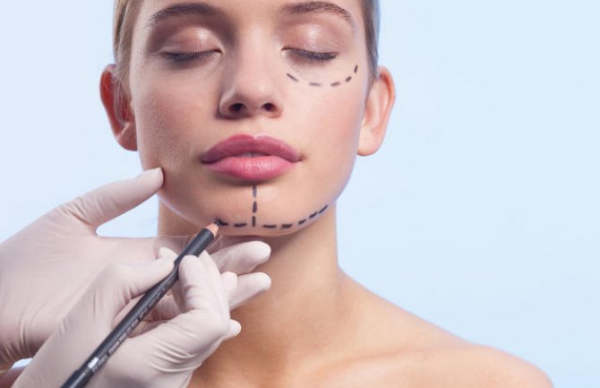 Estetska korekcija popularna i u CG: Dame najviše uvećavaju grudi i usne