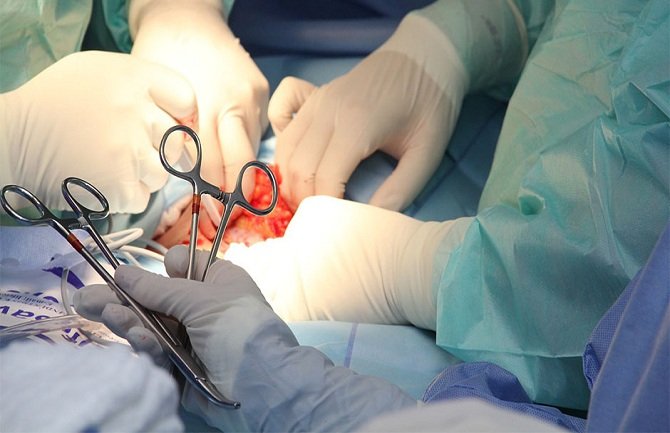 Uspješne transplatacije bubrega sa živog davaoca