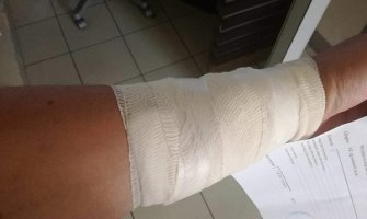 Podgorica: Brutalno napadnut pripadnik LGBT populacije