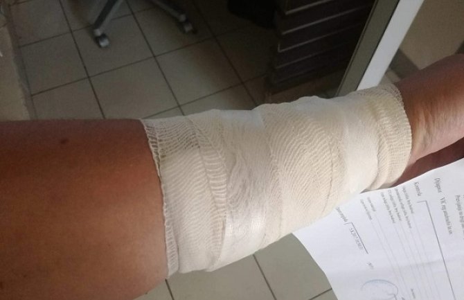 Podgorica: Brutalno napadnut pripadnik LGBT populacije