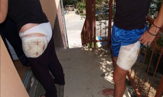 Nakon napada u Banjaluci: Za sve što pas napravi odgovoran vlasnik