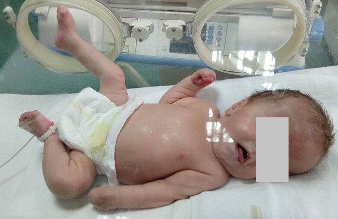 Hitno potrebna pomoć za bebu iz Budve!