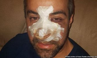 Bjeković: Napad na Tomkića akt vandalizma i bezumlja