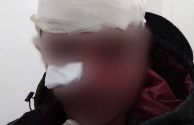 Uznemirujući snimci iz Nikšića, krvave glave, više povrijeđenih policajaca i navijača (VIDEO)