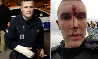 Povrijeđeno 6 policajaca, UP detaljno analizira događaj