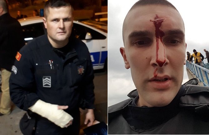 Povrijeđeno 6 policajaca, UP detaljno analizira događaj