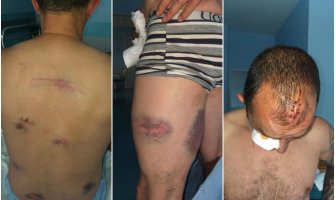 Nove uznemirujuće fotografije povrijeđenih navijača (FOTO)