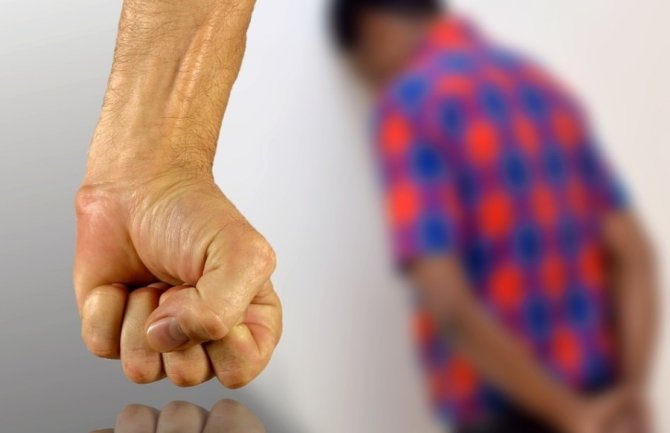 Sa polomljenom vilicom učenika poslali kući