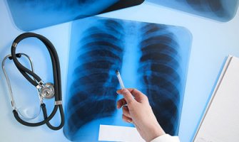 Tri radiologa na 250.000 stanovnika