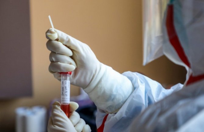  U Crnoj Gori pod zdravstveno-sanitarnim nadzorom 2.662 osobe