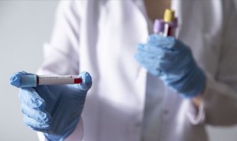 U Crnoj Gori 85 zaraženih koronavirusom