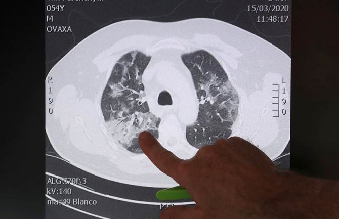 Koronavirus umire za PET minuta na temperaturi od 70 stepeni