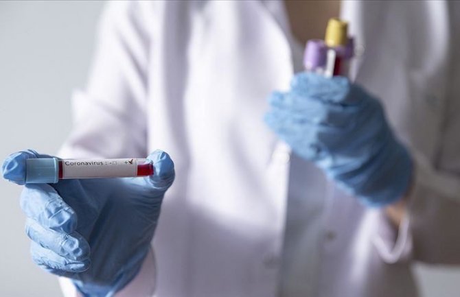 Novih 11 inficiranih koronavirusom, ukupno 120