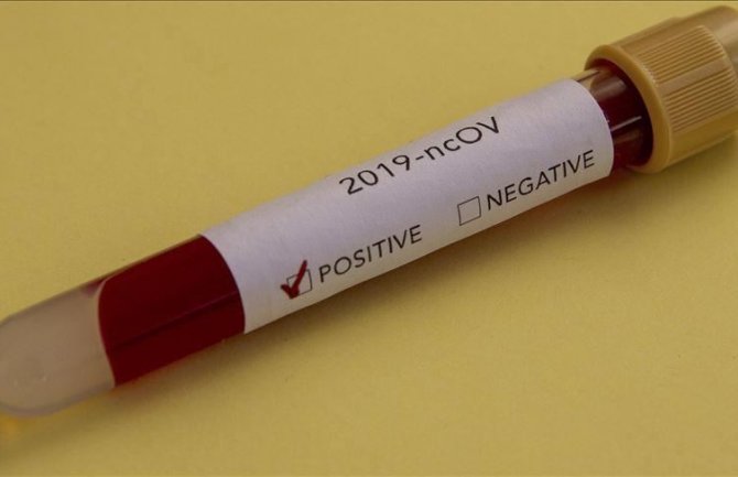 Još 11 zaraženih u Crnoj Gori, ukupno 214