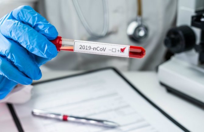 Još sedan novih slučajeva koronavirusa u Crnoj Gori, ukupno 248