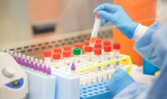 Jedan novi slučaj koronavirusa, 90 osoba se oporavilo