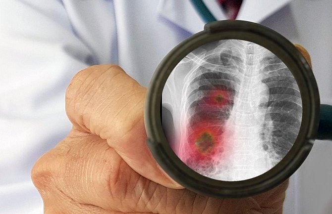 Italija: Najmanje zaraženih u protekla dva mjeseca