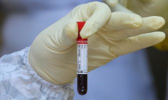 Osam pacijenata preminulo, 279 novopozitivnih 