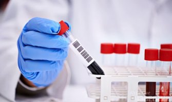 Još jedan dan bez oboljelih od koronavirusa, oporavljenih 307