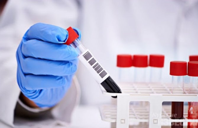 Još jedan dan bez oboljelih od koronavirusa, oporavljenih 307