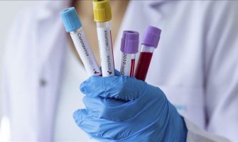 Nema novih slučajeva koronavirusa, oboljelih i dalje četvoro