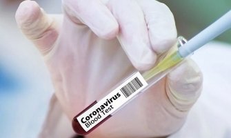 Srbija: 93 nova slučaja zaraze koronavirusom, preminula još jedna osoba