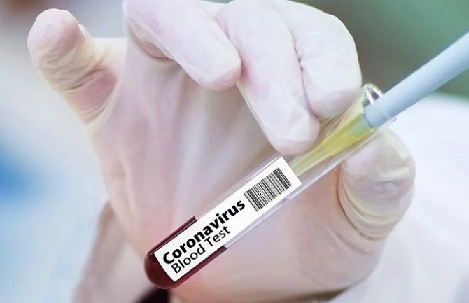 Srbija: 93 nova slučaja zaraze koronavirusom, preminula još jedna osoba