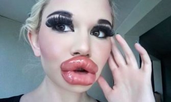 Ovo je vlasnica najvećih usana na svijetu (FOTO)