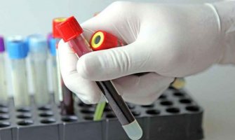 Još 3 slučaja koronavirusa, novooboljeli  iz Podgorice, Danilovgrada i Budve