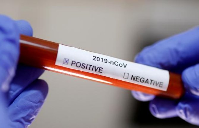 U Crnoj Gori još 53 inficiranih koronavirusom, čeka se nalaz za još jednog preminulog