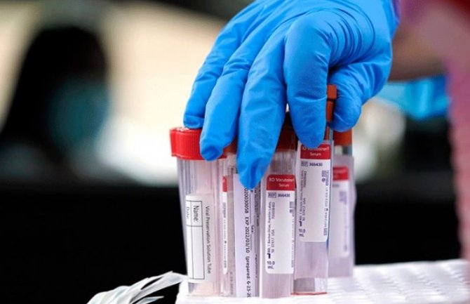 U Crnoj Gori danas 48 zaraženih, virus odnio još dva života 