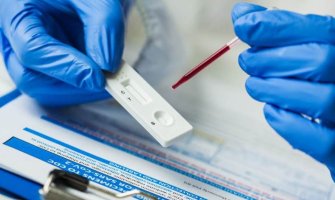 Testiranje pomoraca moguće u Karasovićima, cijena testa od 300 do 450 eura