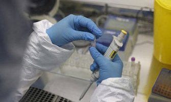 Test za koronavirus morao da plati 450 eura
