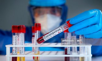 Preminula jedna osoba, 378 novopozitivnih