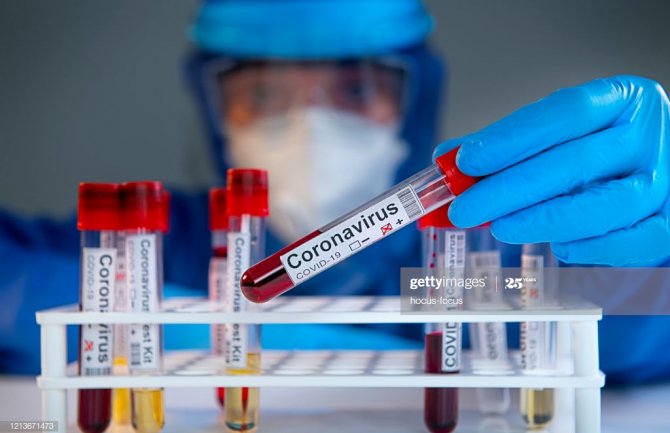 Preminula jedna osoba, 378 novopozitivnih