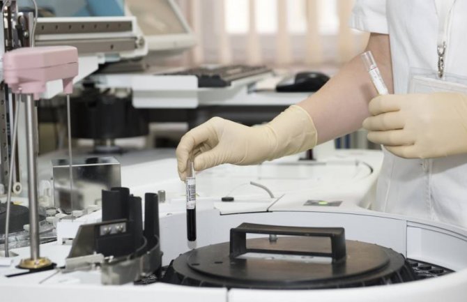 Još 75 novoinficiranih, preminula dva pacijenta iz Berana i Pljevalja