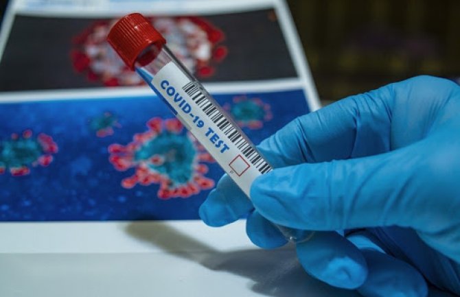 Jedna osoba izgubila bitku sa virusom, još 147 novopozitivnih