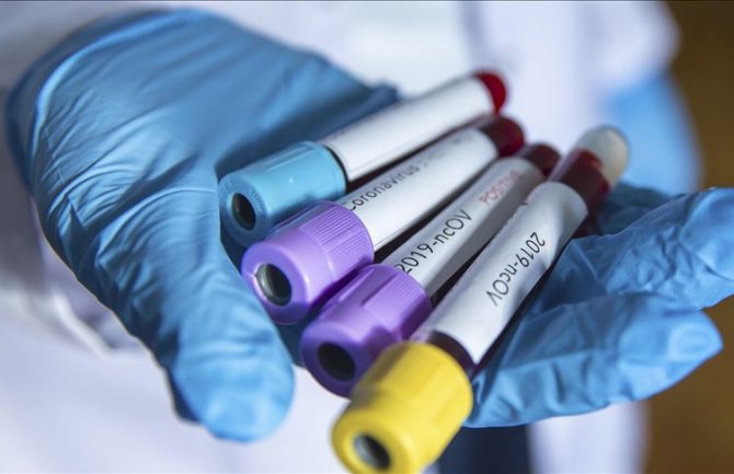 U Sj. Makedoniji od korone preminulo pet osoba, 127 inficiranih