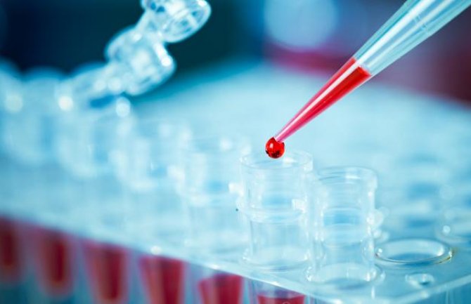 Jedna osoba preminula od koronavirusa, još 187 novopozitivnih