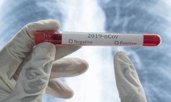 Crna Gora i Slovenija sa najviše aktivno oboljelih 