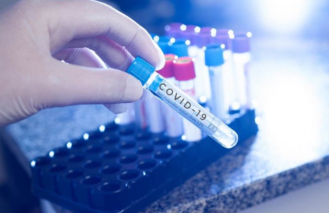 Još 465 slučajeva korone, jedan pacijent preminuo 