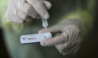 Uskoro nove količine: Nabaviće preko 65 hiljada brzih antigenskih testova