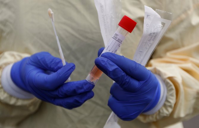 SAD: U prodaji brzi test na koronavirus za ličnu upotrebu