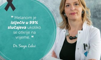 Melanom izlječiv u 99% slučajeva ukoliko se otkrije na vrijeme