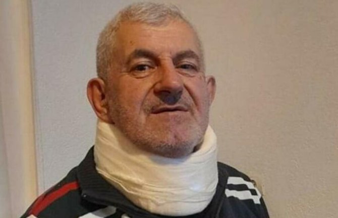 Hadžibegoviću u bjelopoljskoj bolnici konstatovane lakše tjelesne povrede