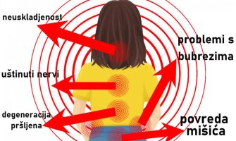 NIJE SVEJEDNO GDE VAS BOLE LEĐA: Često su pokazatelj podmuklih bolesti, a evo kad treba hitno da se javite lekaru! 